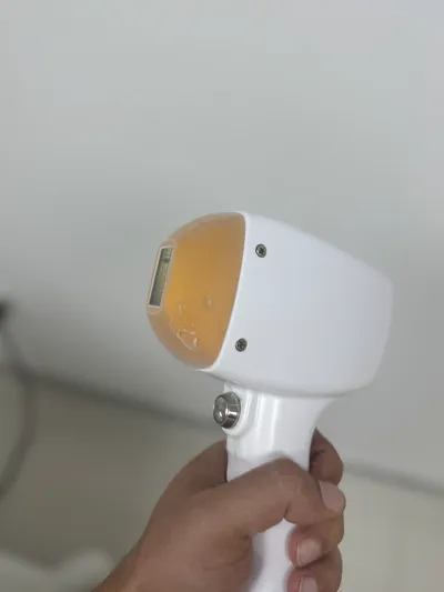 Lazer Epilasyon