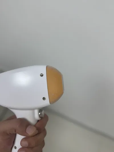 Lazer Epilasyon